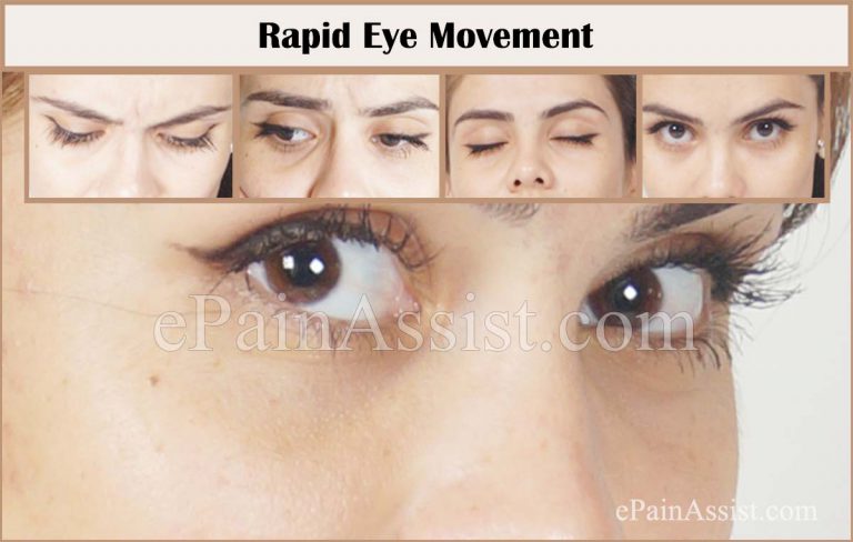 Rapid Eye Movement (REM) Sleep Behavior Disorder: Tests, Treatment