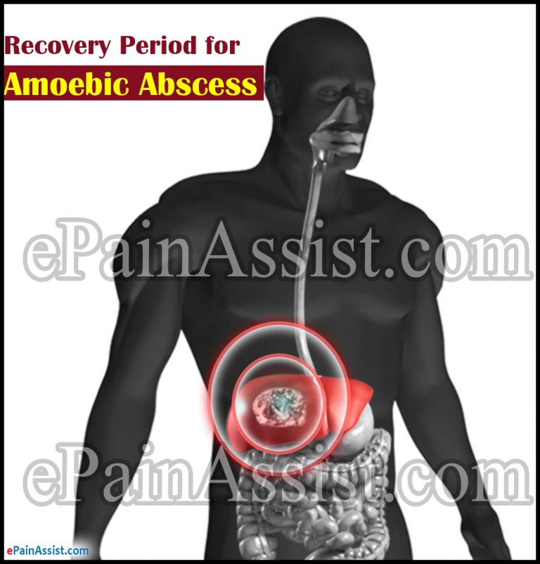 Amoebic Abscess or Amoebic Liver Abscess: Recovery Period, Prevention, Prognosis, Coping