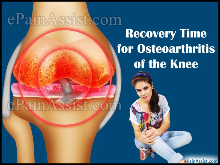 Osteoarthritis of the Knee: Recovery Time, Coping Tips, Exercises