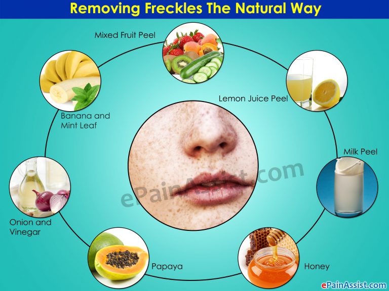 Remove Freckles the Natural Way