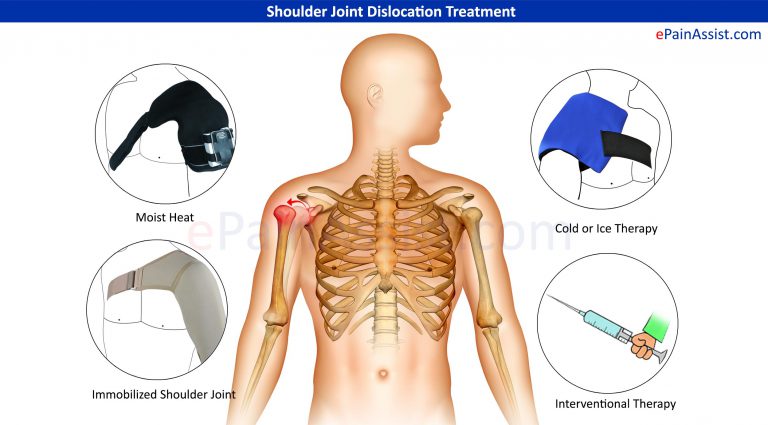 Shoulder Joint Dislocation: Symptoms, Signs, Investigations, Treatment