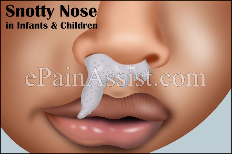 Snotty Nose in Infants, Children & Adults and its Home Remedies