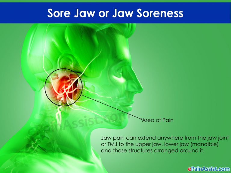 Sore Jaw or Jaw Soreness: Symptoms, Causes, Diagnosis, Treatment