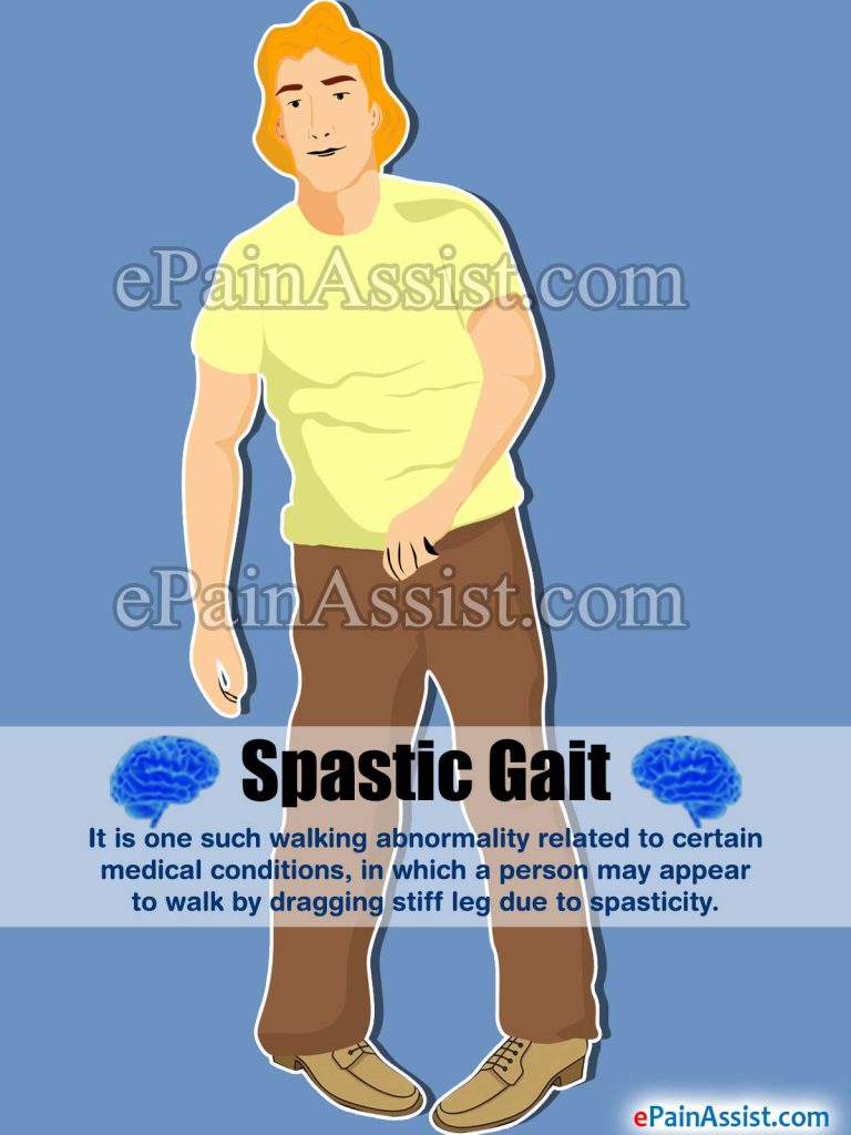 Spastic Gait: Causes, Treatment, Rehabilitation