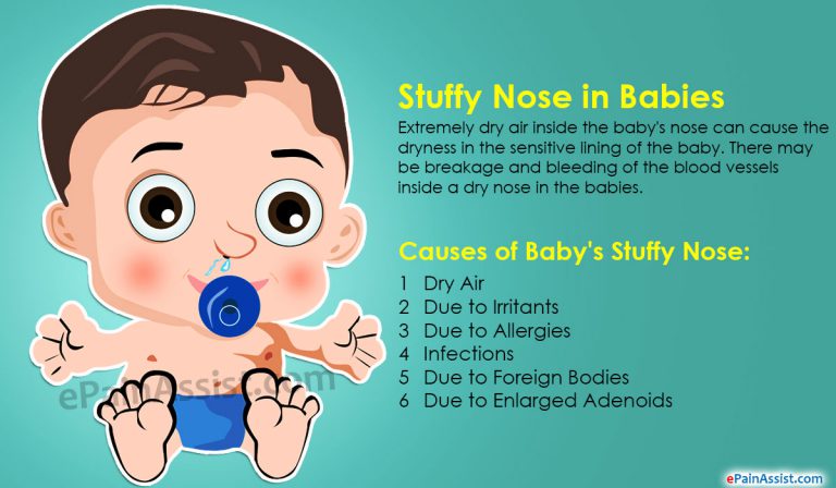 How to Get Rid of Baby’s Stuffy Nose?