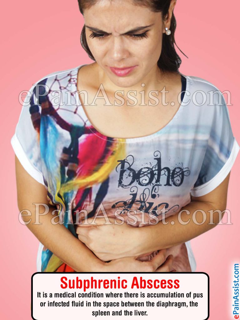 Subphrenic Abscess: Causes, Signs, Symptoms, Treatment