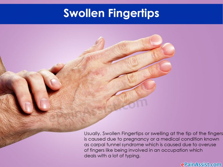 Swollen Fingertips: What Can Cause Swelling at the Tip of the Fingers