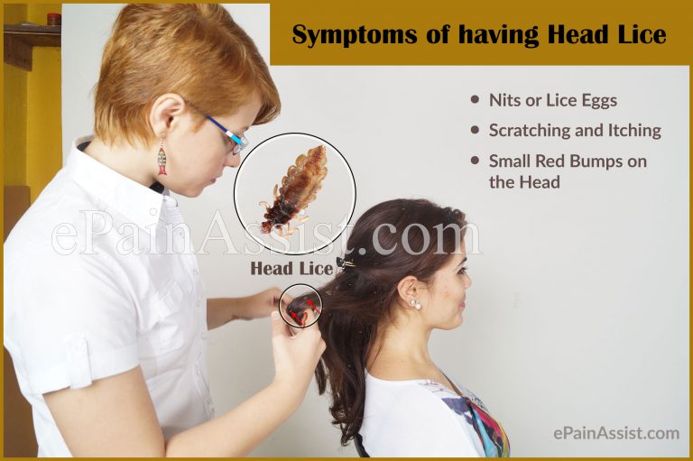 How Do You Get Lice and Ways to Get Rid of it?