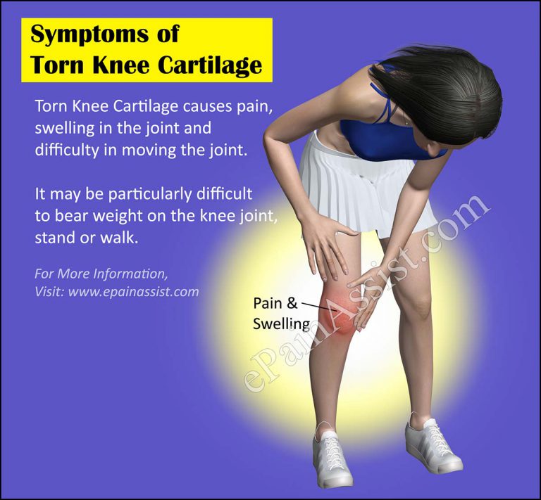 Torn Knee Cartilage: Causes, Treatment, Recovery Period, Symptoms