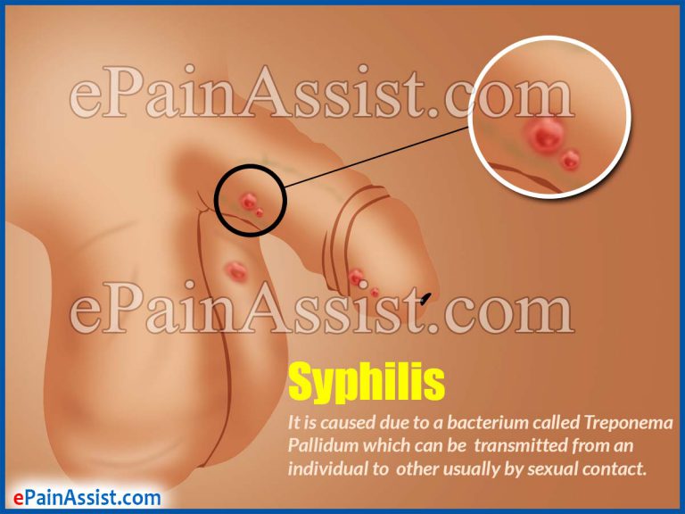 Syphilis: Causes, Symptoms, Diagnosis, Treatment
