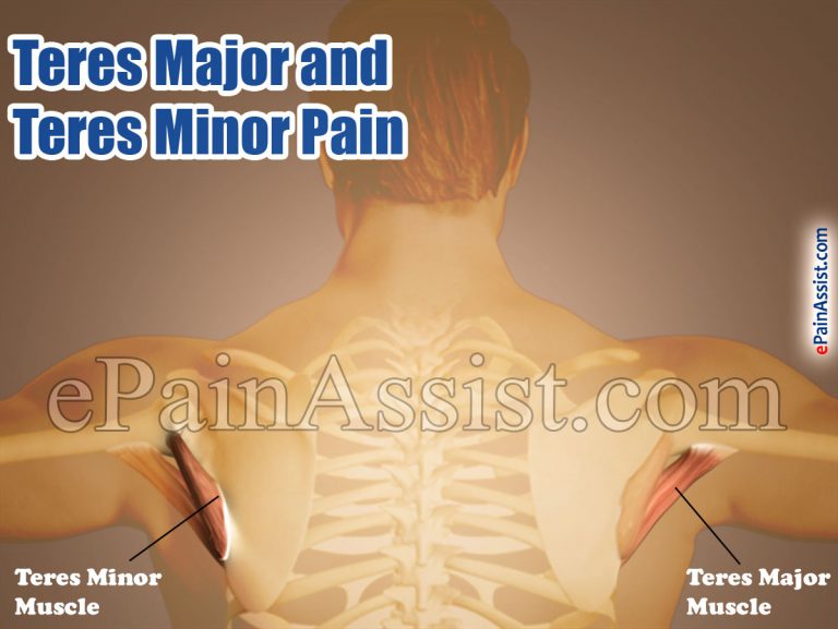 Teres Major and Teres Minor Pain: Causes, Symptoms, Treatment, Exercises