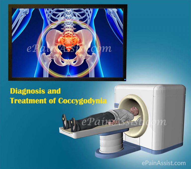 Diagnosis and Treatment of Coccygodynia or Coccygeal Pain