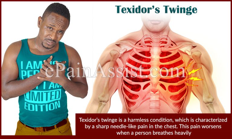 Texidor’s Twinge: Causes, Symptoms, Treatment, Prevention