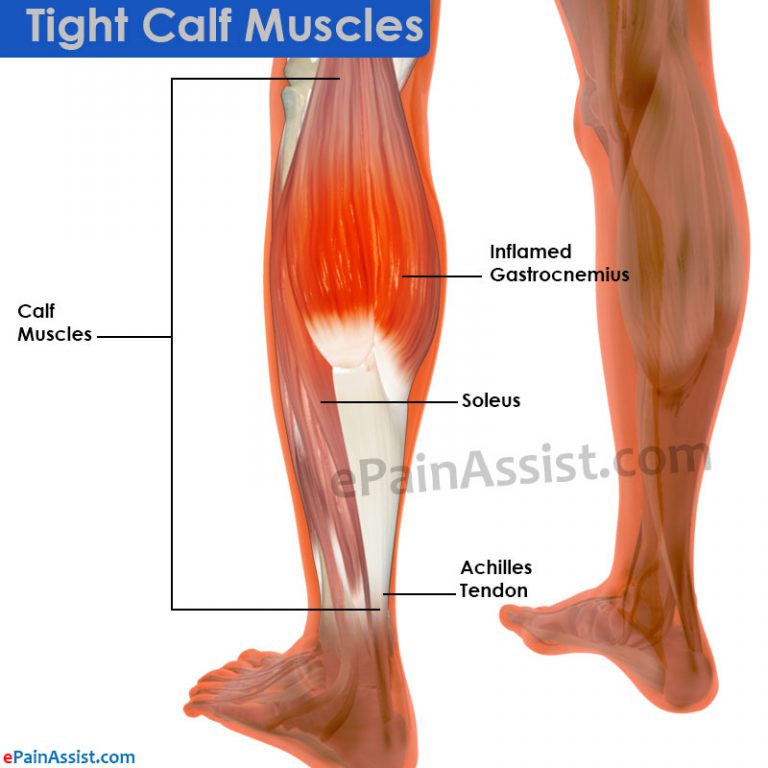 Tight Calf Muscles: Causes, Treatment- Stretching Exercises, Gastrocnemius, Soleus
