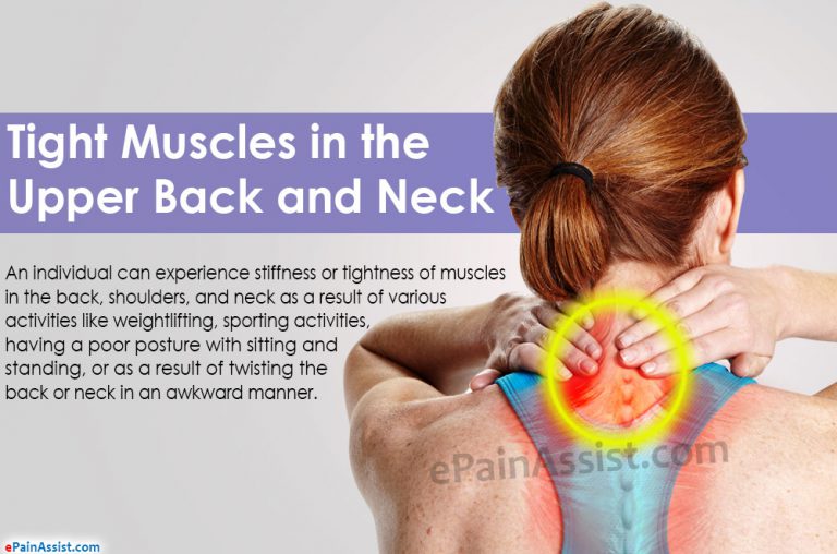 Tight Muscles in the Upper Back and Neck: Causes, Symptoms, Treatment, Exercise