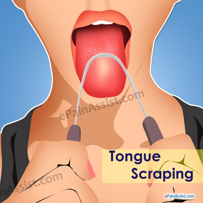Tongue Scraping: Benefits, Disadvantages, Tools for Tongue Cleaning