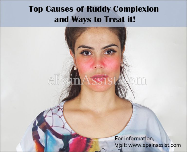 Top Causes of Ruddy Complexion and Ways to Treat it!