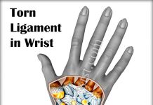Wrist Injuries|broken|bruised|Sprain|bursitis|carpal tunnel syndrome