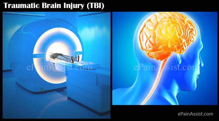 Traumatic Brain Injury (TBI) or Intracranial Injury: Lifestyle Changes, Rehab