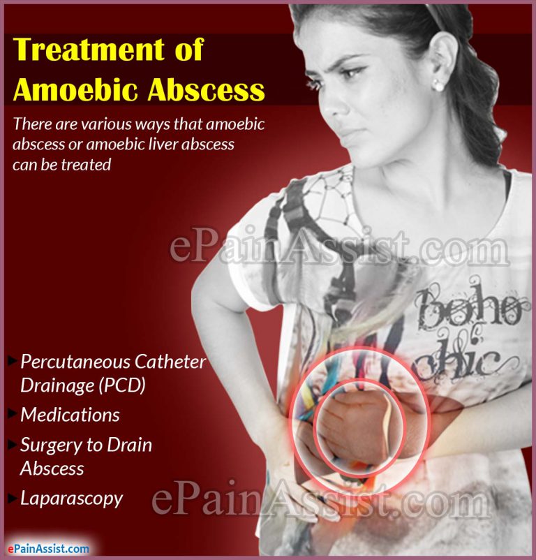 Treatment of Amoebic Abscess or Amoebic Liver Abscess