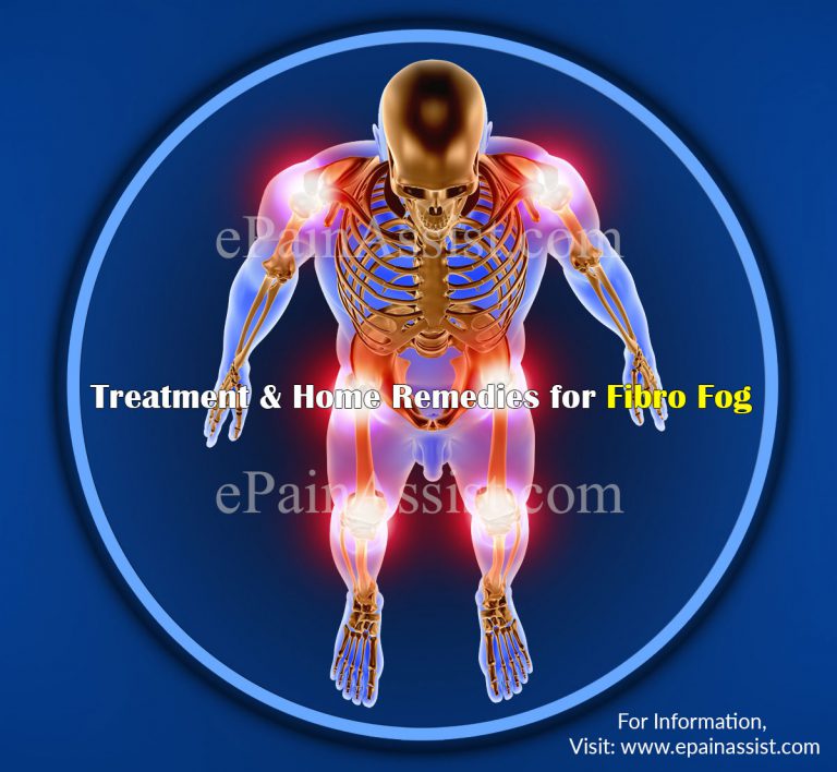 Treatment & Home Remedies for Fibro Fog