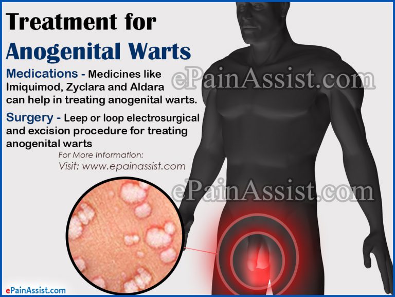 Treatment for Anogenital Warts & its Recovery Period, Prognosis