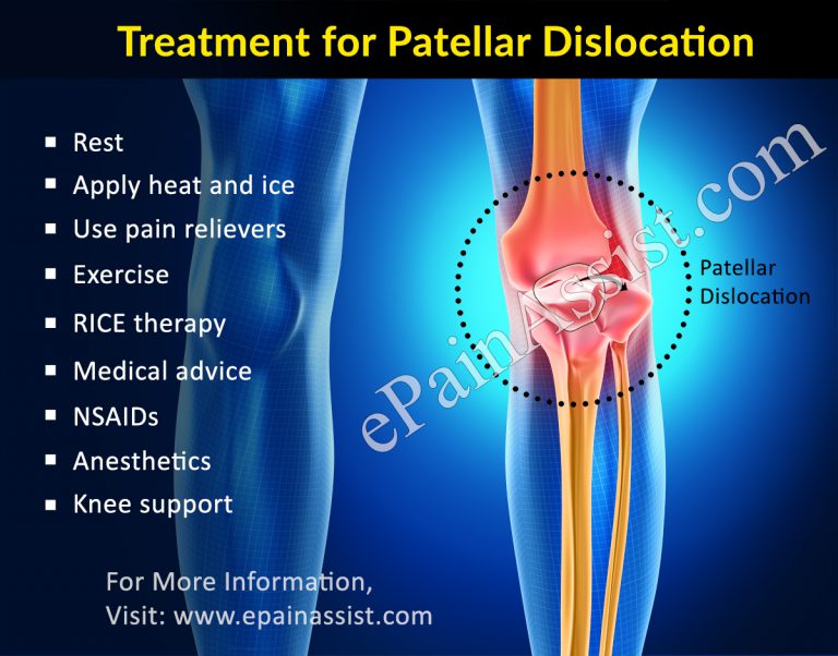 Treatment, Surgery, PT for Patellar Dislocation or Kneecap Dislocation
