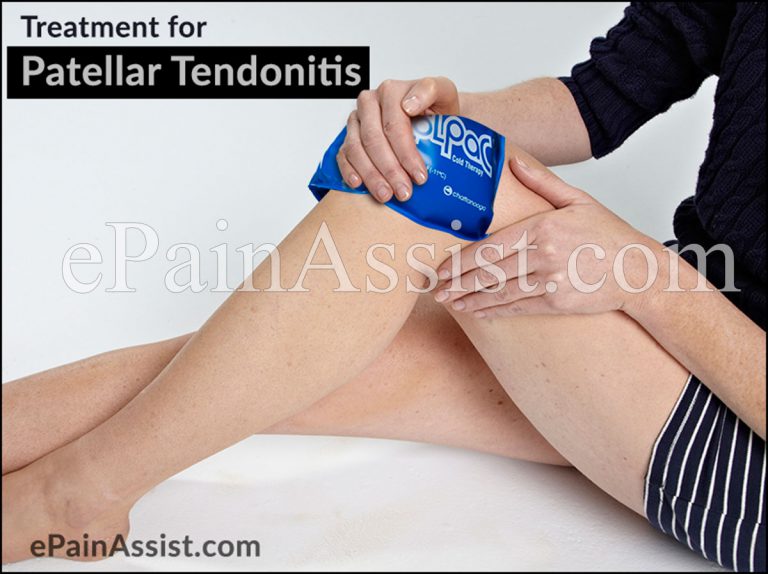Patellar Tendonitis or Jumper’s Knee: Treatment, PT, Surgery, Rehab