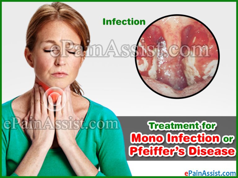 Treatment for Mono Infection or Pfeiffer’s Disease: Alternative Medicine & Treatment,Diet, Prognosis