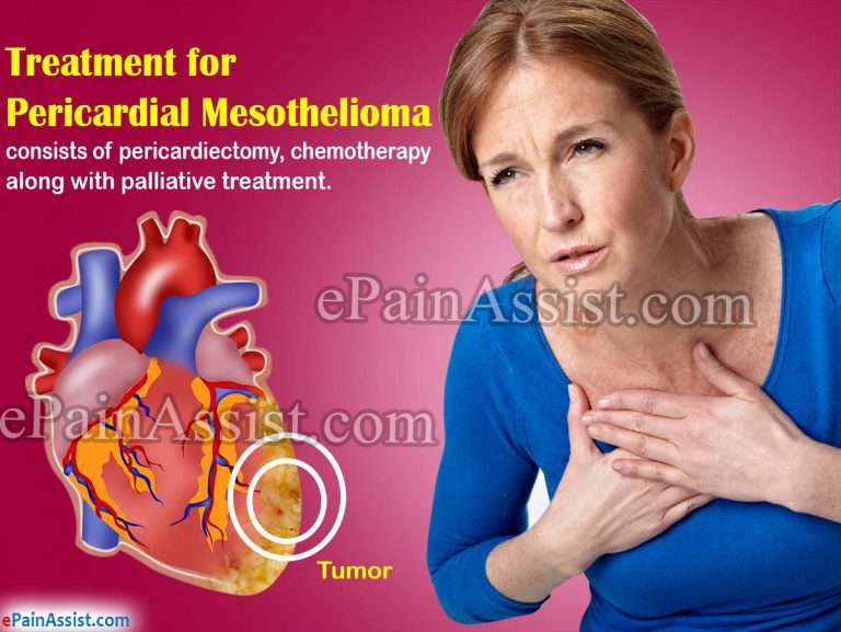 Pericardial Mesothelioma: Treatment, Risk Factors, Coping