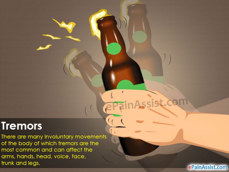 Tremors: Causes, Types, Categories, Treatment, Surgery