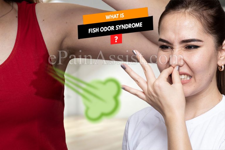 Trimethylaminuria : What Is Fish Odor Syndrome & What Makes A Person Smell Like Fish Or Rotten Eggs?