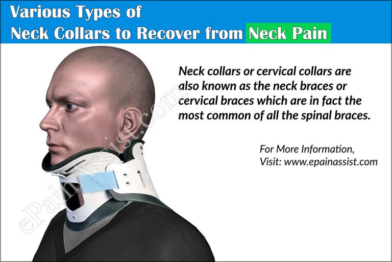 Various Types of Neck Collars to Recover from Neck Pain