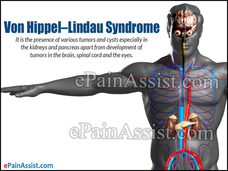 Von Hippel–Lindau Syndrome: Causes, Symptoms, Treatment