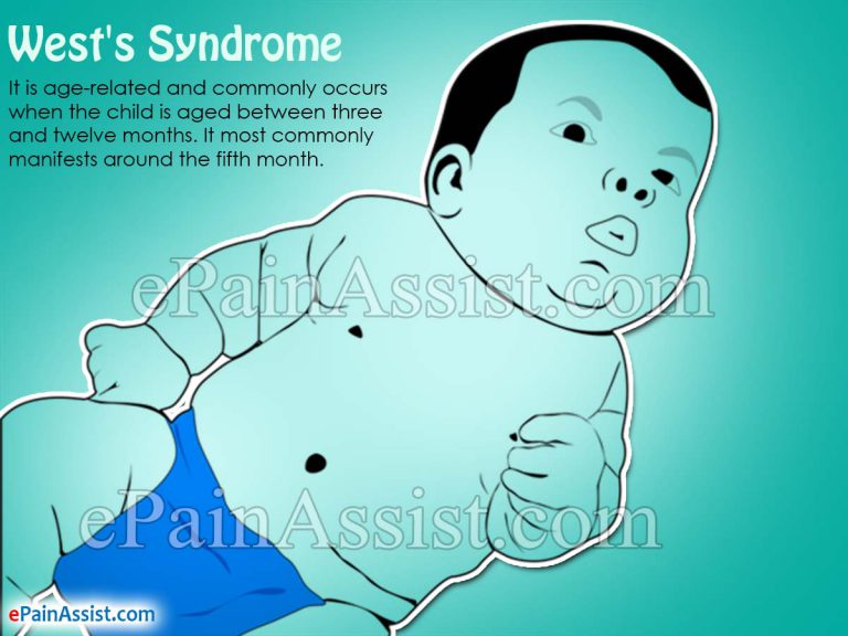West’s Syndrome: Causes, Symptoms, Treatment, Life Expectancy, Prognosis