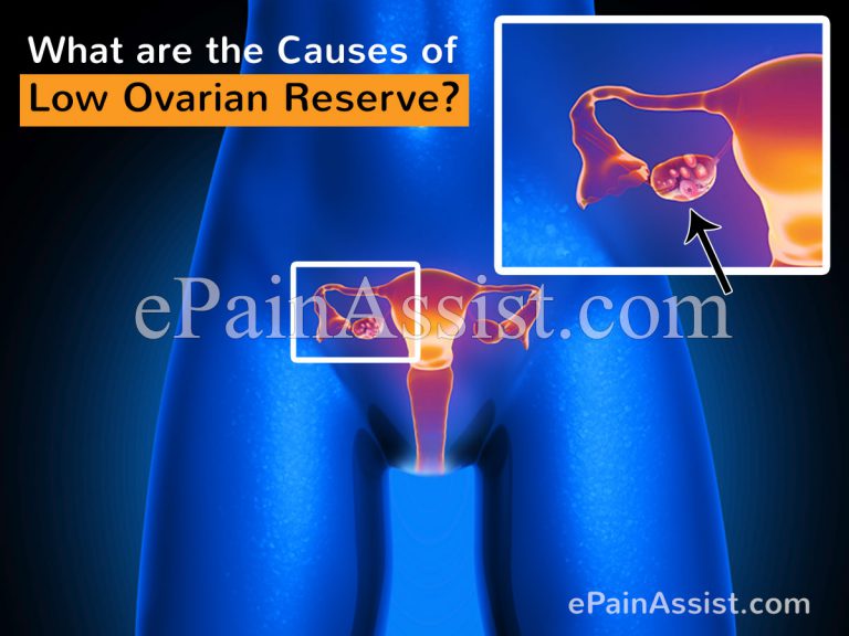 Low Ovarian Reserve: Causes, Treatment, Diagnosis