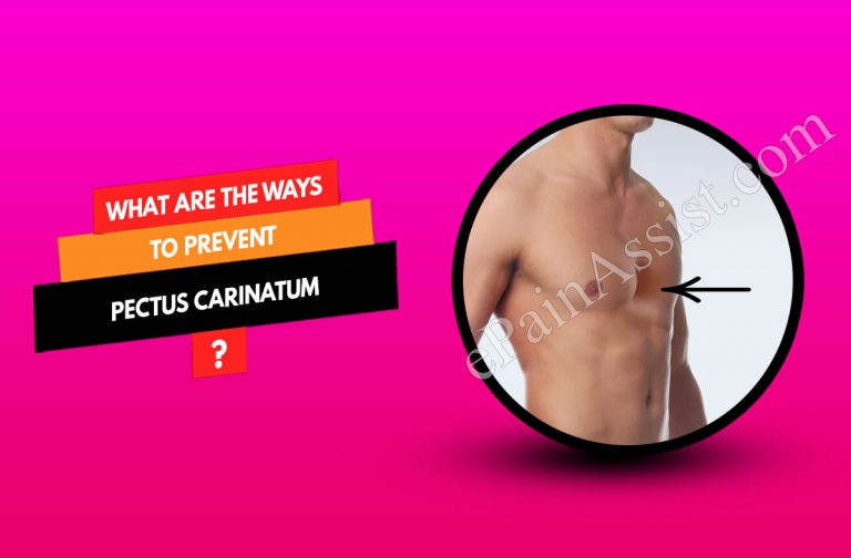 What Are The Ways To Prevent Pectus Carinatum & Does It Reoccur?
