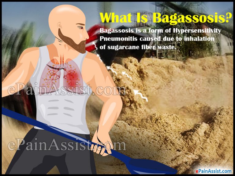 Bagassosis: Causes, Symptoms, Diagnosis, Treatment, Prevention