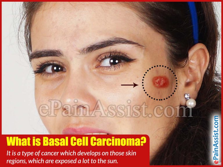 What Is Basal Cell Carcinoma And How Can It Be Treated?