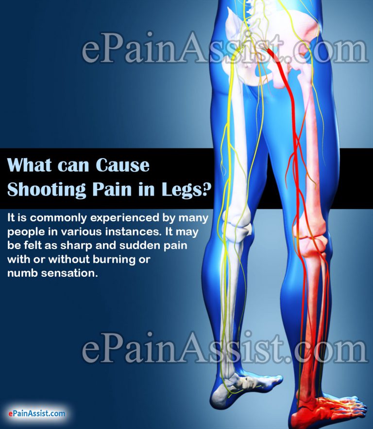 What Can Cause Shooting Pain In Legs?