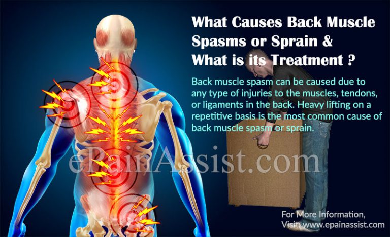 What Causes Back Muscle Spasms or Sprain & What is its Treatment, Prevention