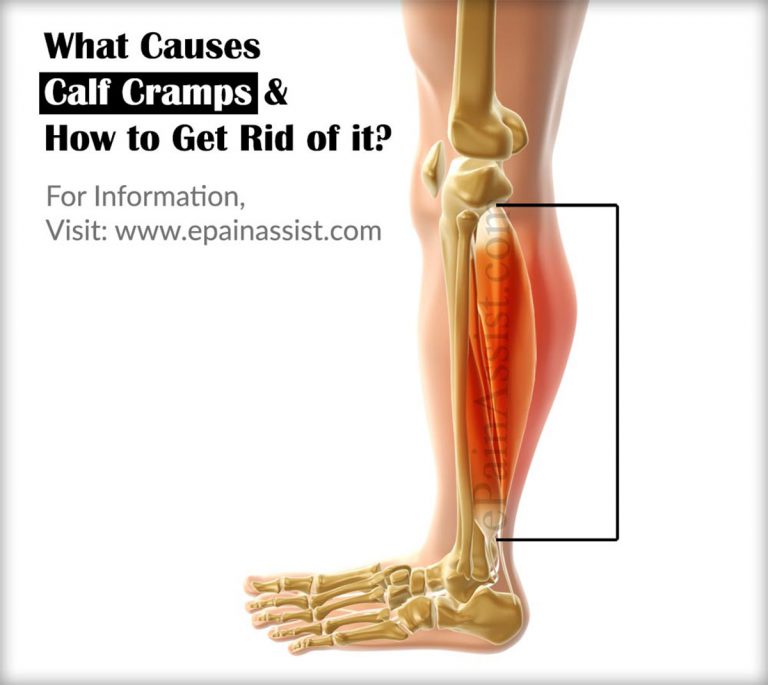 What Causes Calf Cramps & How to Get Rid of it?