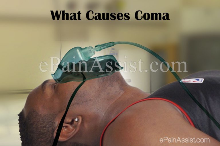 What Causes Coma or Comatose and What are its Symptoms?