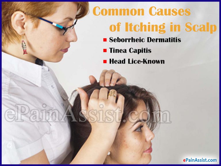 What Causes Itching in Scalp: Treatment & Home Remedies to Get Rid of Itching in Scalp