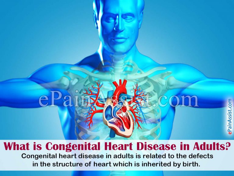 Congenital Heart Disease in Adults: Causes, Signs, Symptoms, Is it Safe to Exercise with Congenital Heart Disease