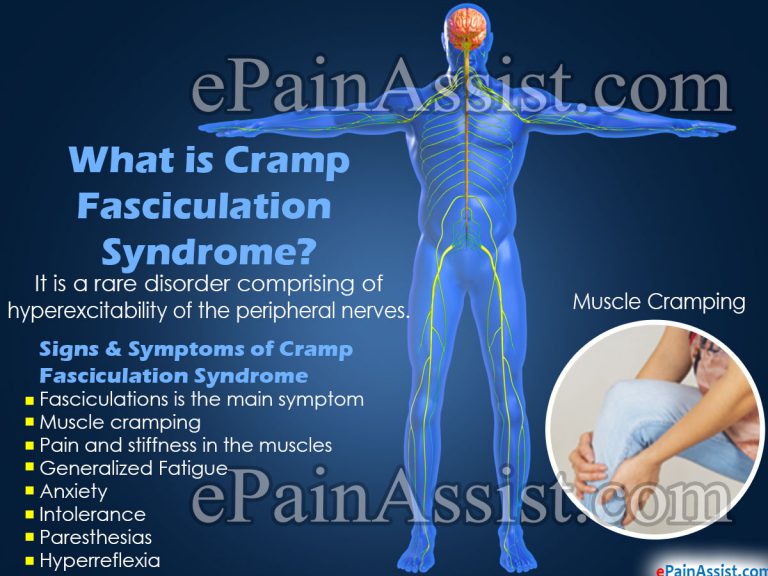 Cramp Fasciculation Syndrome: Causes, Symptoms, Treatment