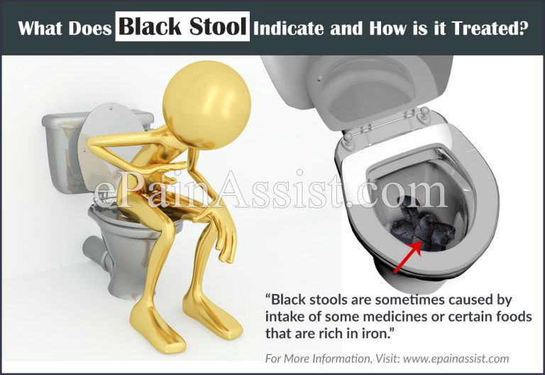 What Does Black Stool Indicate and How is it Treated?