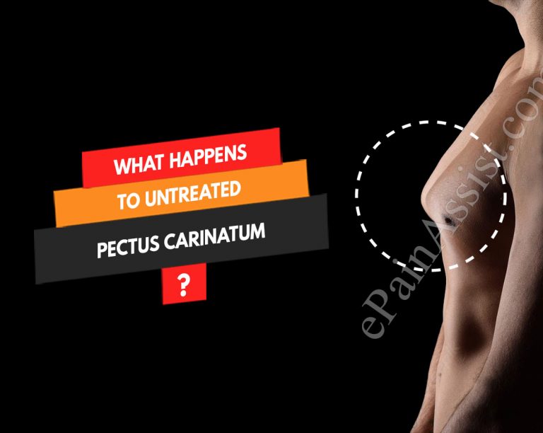 What Happens To Untreated Pectus Carinatum & When To Go To Doctor?