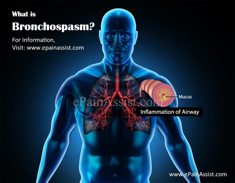 What is Bronchospasm: Symptoms, Treatment, Causes, Pathophysiology, Risk Factors, Prevention