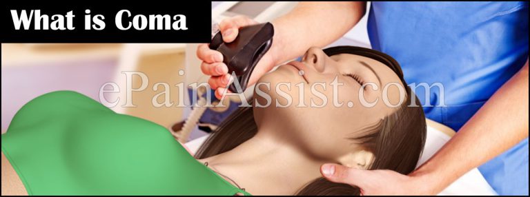 What is Coma or Comatose and What are its Types?